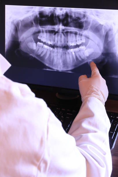 Best Emergency Root Canal Therapy in Portage, WI